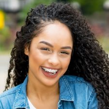 Which Are Faster – Invisalign or Traditional Braces?