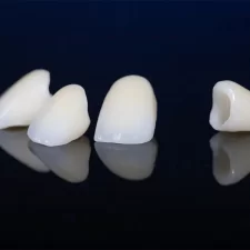 Why Dental Crowns in Cambridge Are the Right Solution for Damaged Teeth